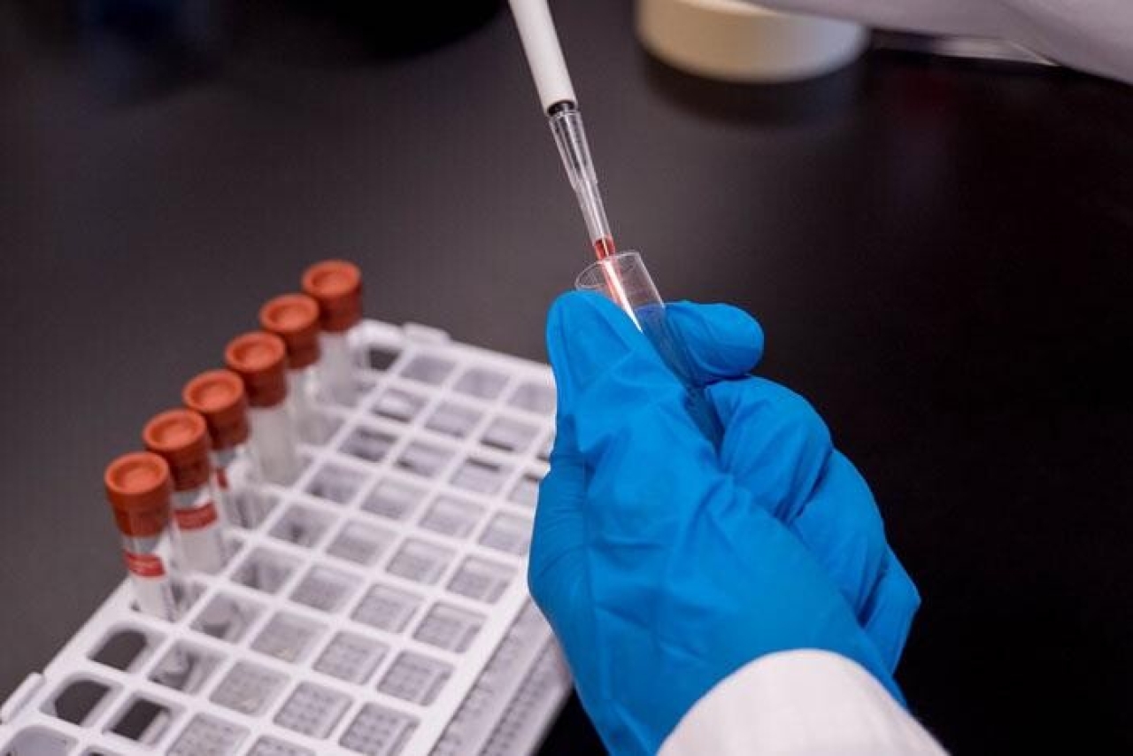 Sullivan County monitoring measles spread
